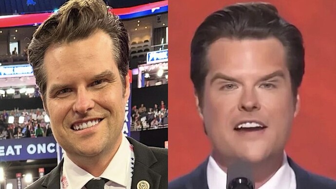 gaetz-before-after